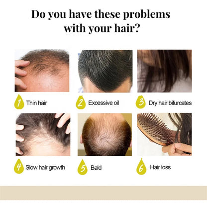 Moisturize Repair Hair/ Hair Growth /Prevent Lost/Anti-Dandruf Polygonum Multiflorum Hair Care Bath Supplies Handmade Soap