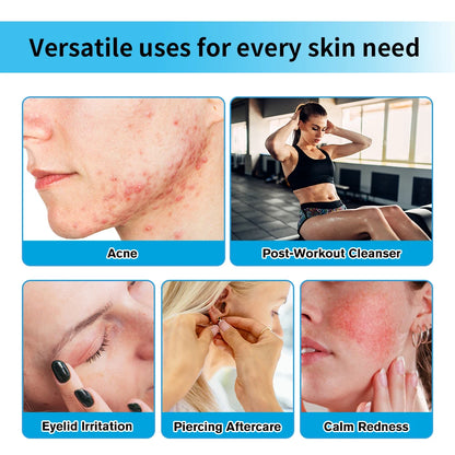 Hypochlorous Acid Facial Spray For daily facial rescue Versatile uses for every skin need Acne Calm Redness Eyelid lrritation