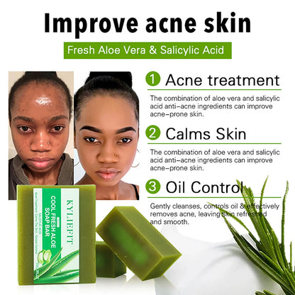 KYLIEFIT Cool Fresh Aloe Soap Bar, Reduce Acne and Black Spots, Clean Skin, Oil Control, Exfoliation, For Face And Body Use