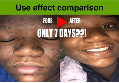 KYLIEFIT Cool Fresh Aloe Soap Bar, Reduce Acne and Black Spots, Clean Skin, Oil Control, Exfoliation, For Face And Body Use