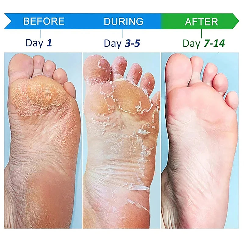 Anti-drying Crack Moisturize Hand Cream Wrinkles Removal Foot Cream Cracked Repair Removal Dead Skin Callus Care Mask Product