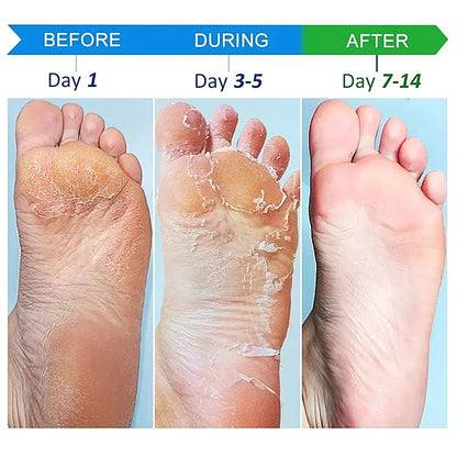 Anti-drying Crack Moisturize Hand Cream Wrinkles Removal Foot Cream Cracked Repair Removal Dead Skin Callus Care Mask Product