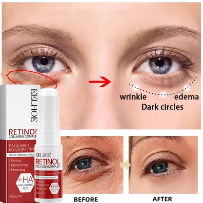 Retinol Wrinkle Remover Facial Serum Set Instant Firming Lift Anti-Aging Cream Fade Fine Lines Whitening Moisturizing Skin Care